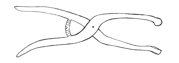 (illustration vente /Aménager l’articulation du gros orteil - pince à cors - AlainMadec.com)